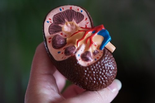 High Creatinine Treatment